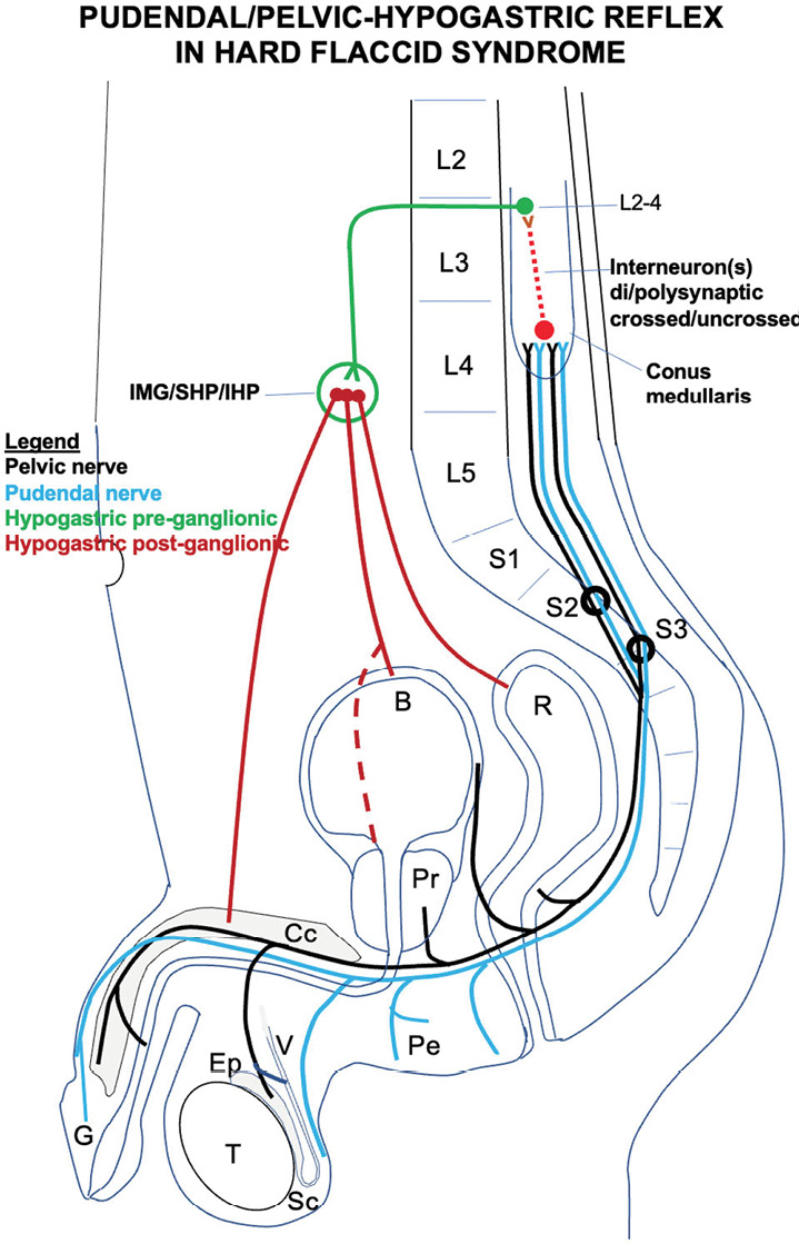 Hard Flaccid Syndrome Proposed to Be Secondary to Pathological Activation  of a Pelvic/Pudendal-Hypogastric Reflex - American Urological Association